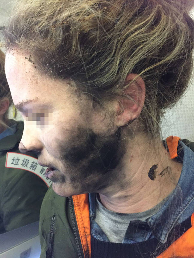 Passenger injured by exploding headphones