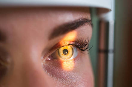 eye scan - Ayyy-EYE! Google code ‘predicts heart disease’ by eyeballing retinas